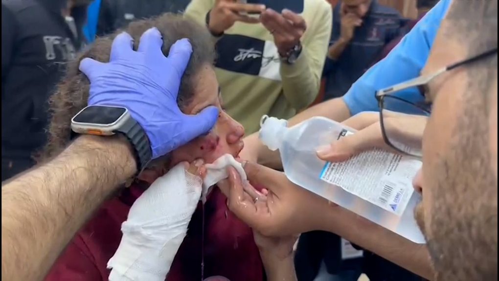Ministère Santé Gaza: Israël intimide malades et personnel à l'Aqsa